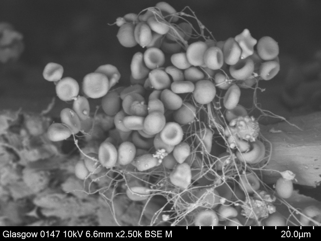 Red Blood Cells